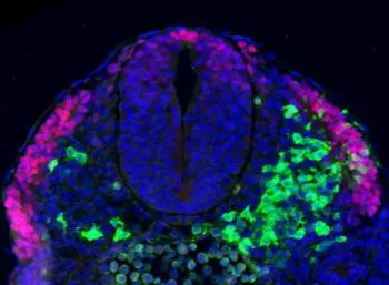 Neuromesodermal progenitors