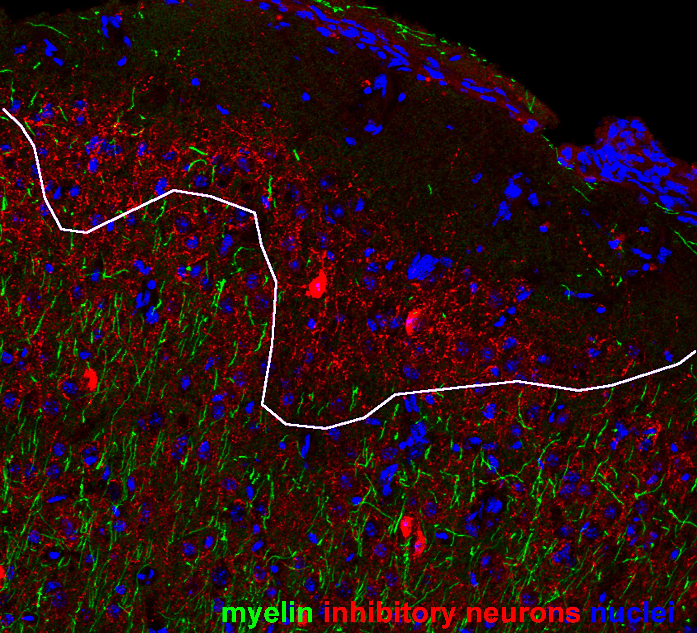 Microscope image of mouse brain showing loss of inhibitory neurones in a model of multiple sclerosis