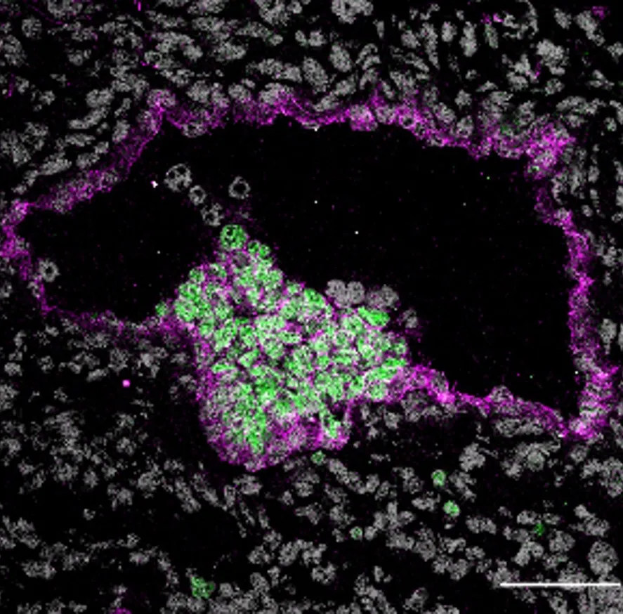 Blood stem and progenitor cells in green bud from the floor of the embryonic dorsal aorta in purple.