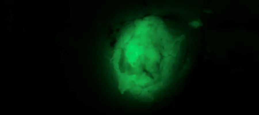 Image of an engineered glioblastoma tagged with a green fluorescent probe