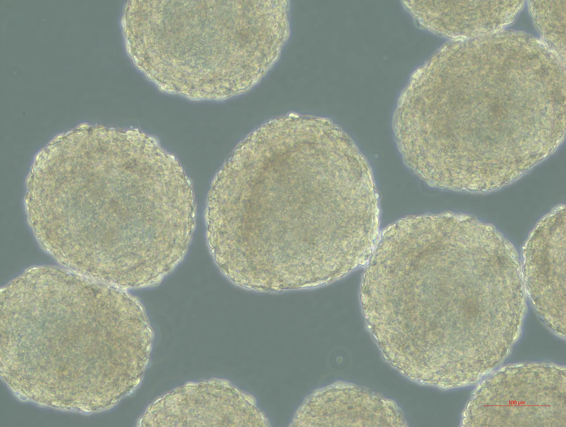 epiblast-like cell aggregates at day 6 of cytokine-free differentiation 