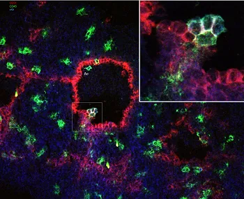 Image of green and purple dots representing cells and a close up square of the image in the corner 