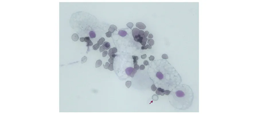 A microscope image showing a red blood cell produced from a co-culture of KLF1 Macrophages and blood precursor cells