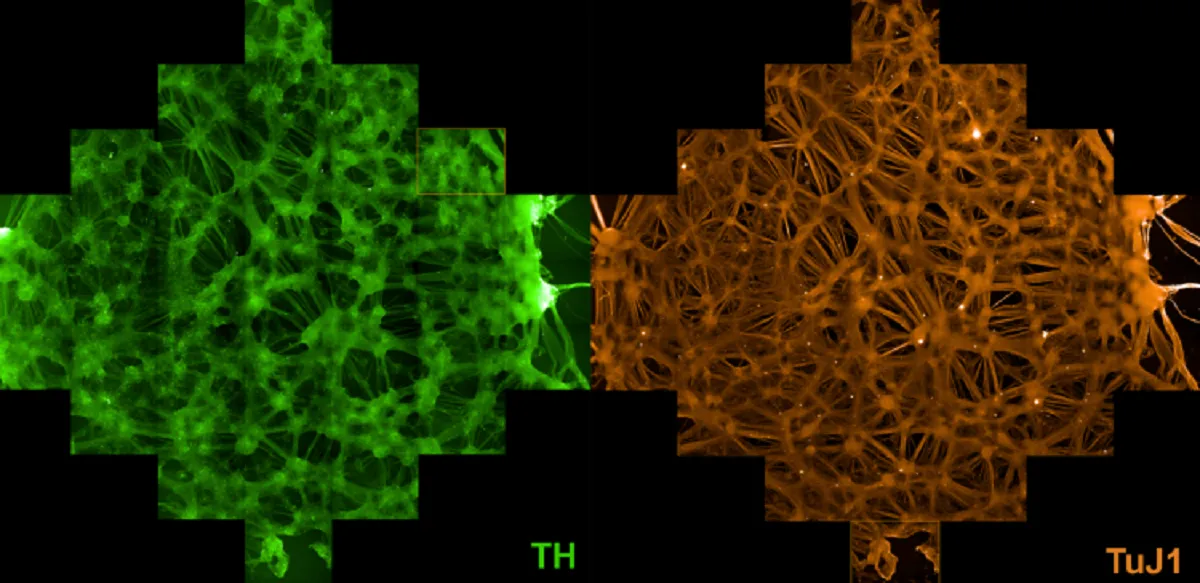 Midbrain dopaminergic neurons differentiated from clinical-grade human embryonic stem cells