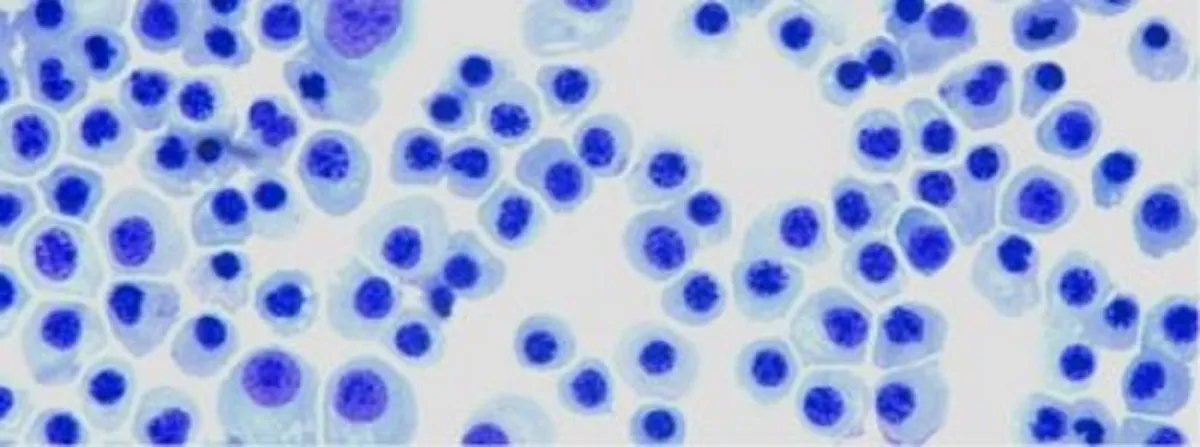 Immature red blood cells