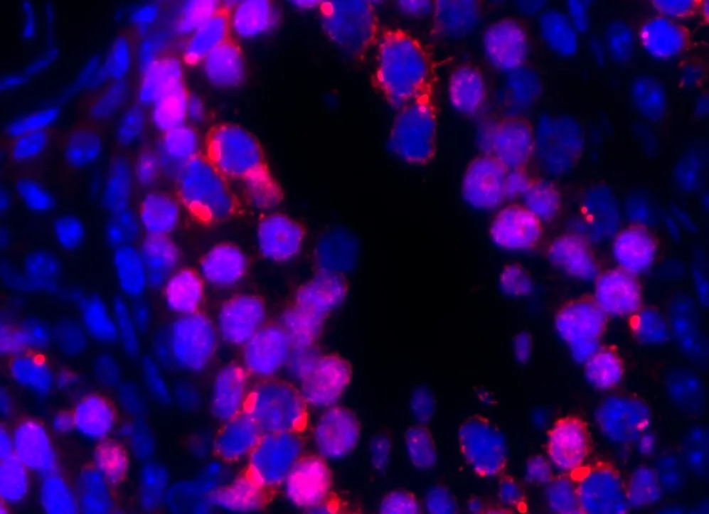 Jumping gene attacking DNA