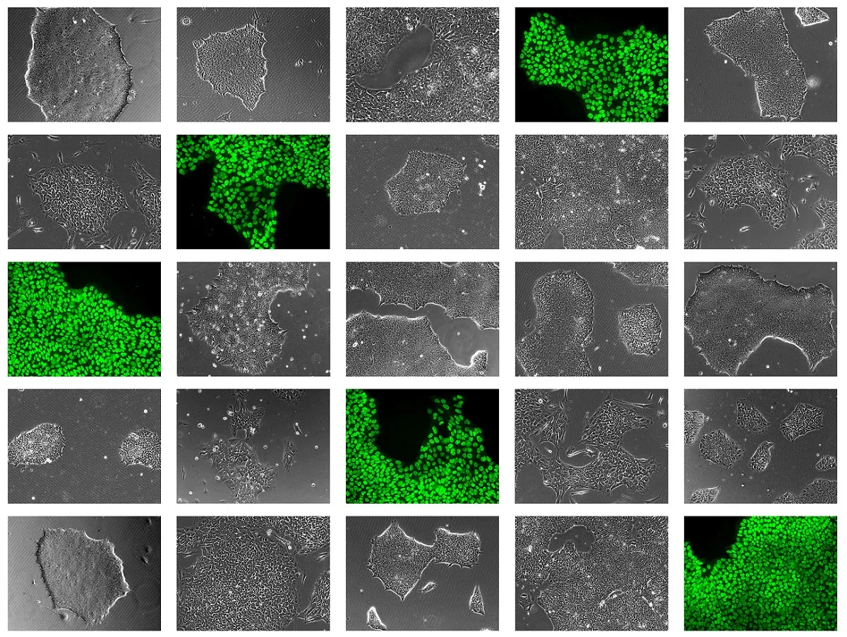 Collection of stem cell lines.