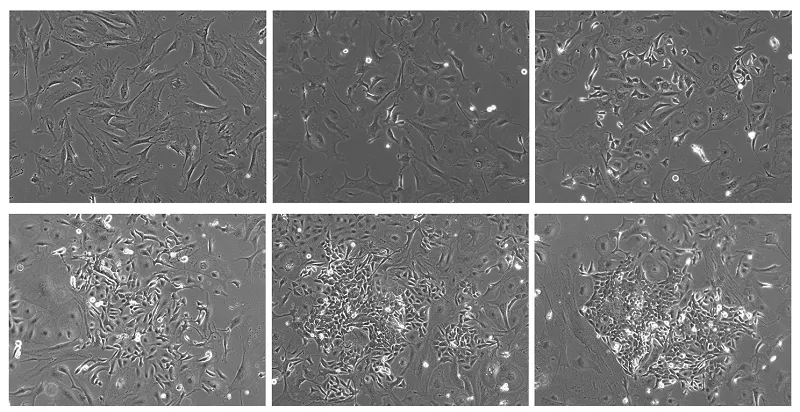 Skin cells becoming induced pluripotent stem cells