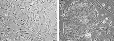 Human fibroblasts (left) reprogrammed into iPSCs (right).