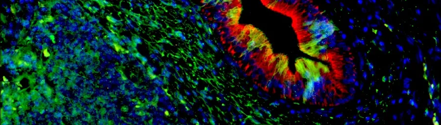 Human bile ducts showing senescence in green