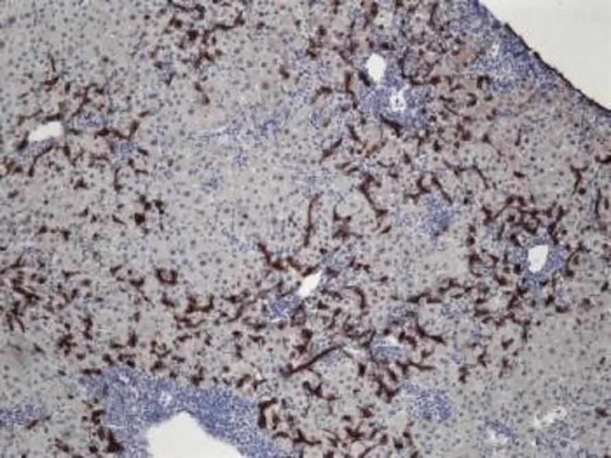 Picture taken by me with a microscope of biliary cells