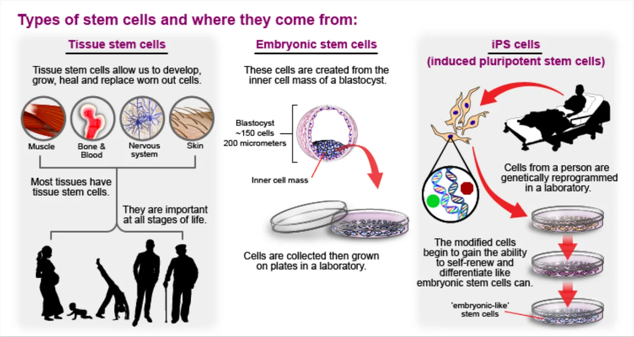 Types of stem cells