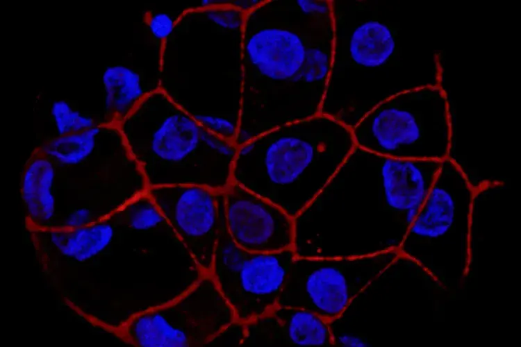tem cell derived liver spheres express a protein