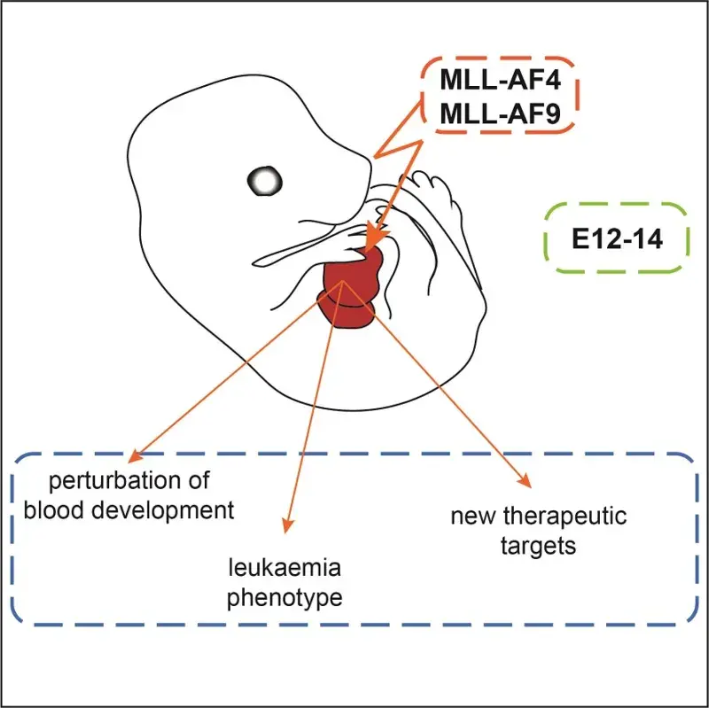 Studying the developmental origins of infant leukaemia