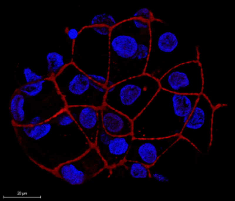 tem cell derived liver spheres express a protein