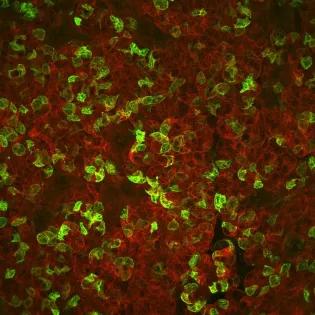 A microscope image of stained cells