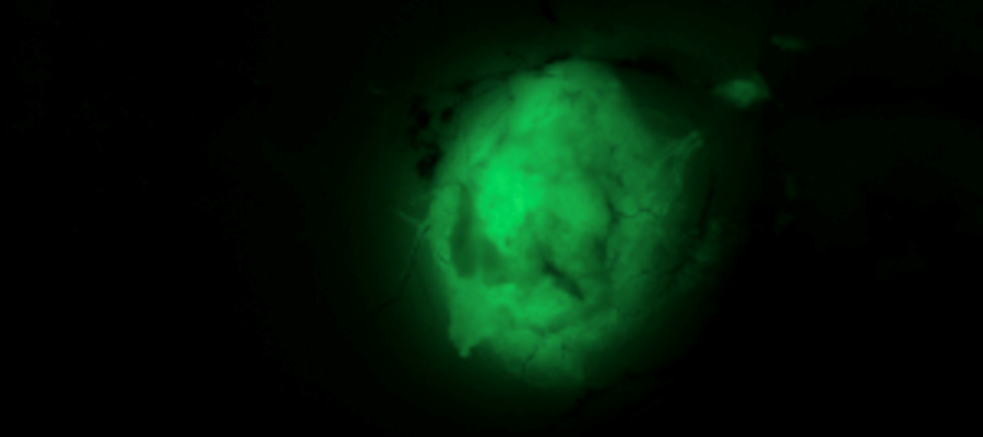 Image of an engineered glioblastoma tagged with a green fluorescent probe