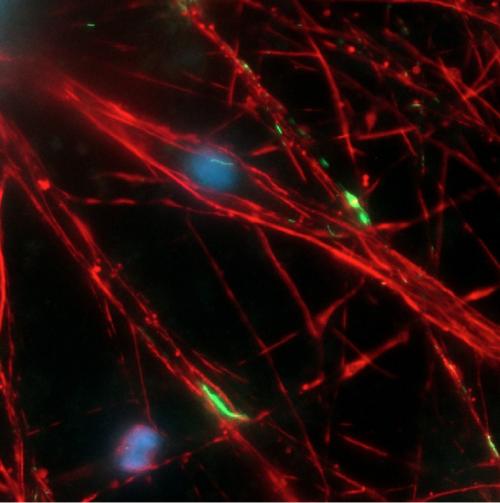 Stem cell-derived dopamine-producing neurons