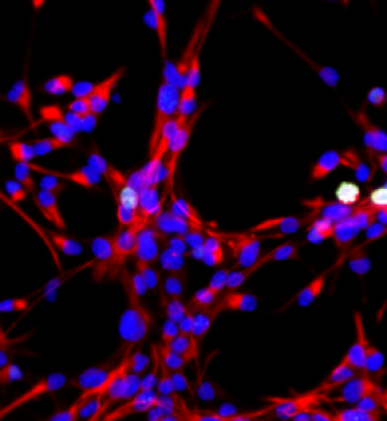 Highly proliferative neural stem cells