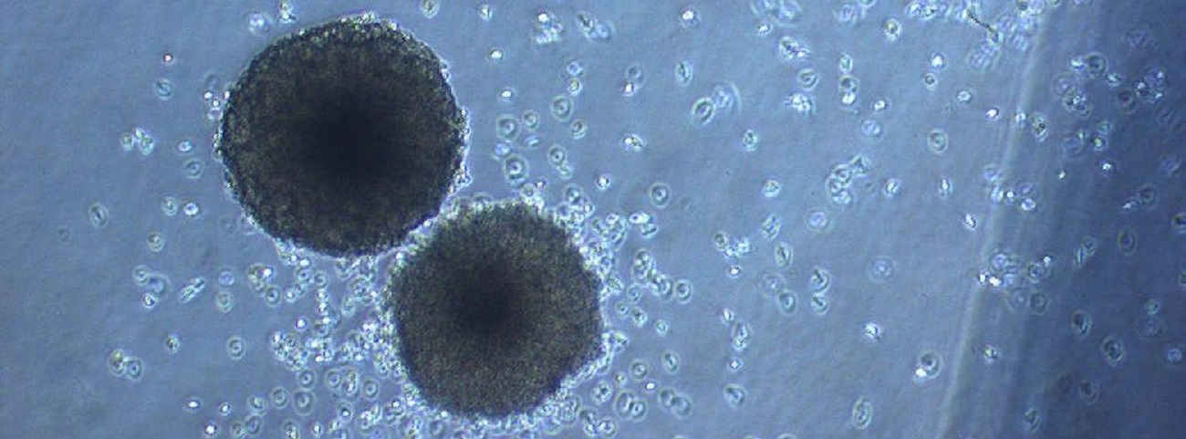 Two leukaemic stem cell colonies