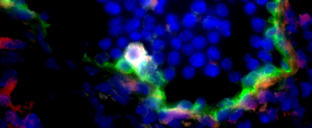 Aorta in an 11 day old mouse embryo with the endothelium of the blood vessel wall in green and cell nuclei in blue. 